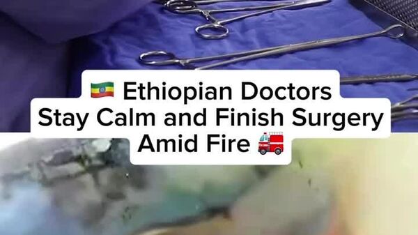 በእሳት መካከል ስኬታማ ቀዶ ሕክምና ያካሄዱት ኢትዮጵያውያን ሐኪሞች - Sputnik አፍሪካ