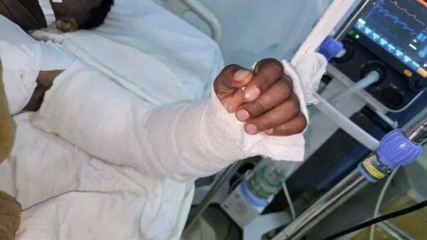 ሳምሪታን ቀዶ ሕክምና ማዕከል ለመጀመሪያ ጊዜ በማሽን የተቆረጠ እጅን በተሳካ ሁኔታ መቀጠል መቻሉን አስታወቀ - Sputnik አፍሪካ